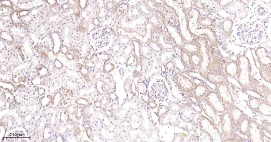 抗增殖蛋白1重组兔单抗-bsm-61208R