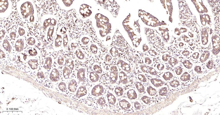 抗增殖蛋白1重组兔单抗-bsm-61208R