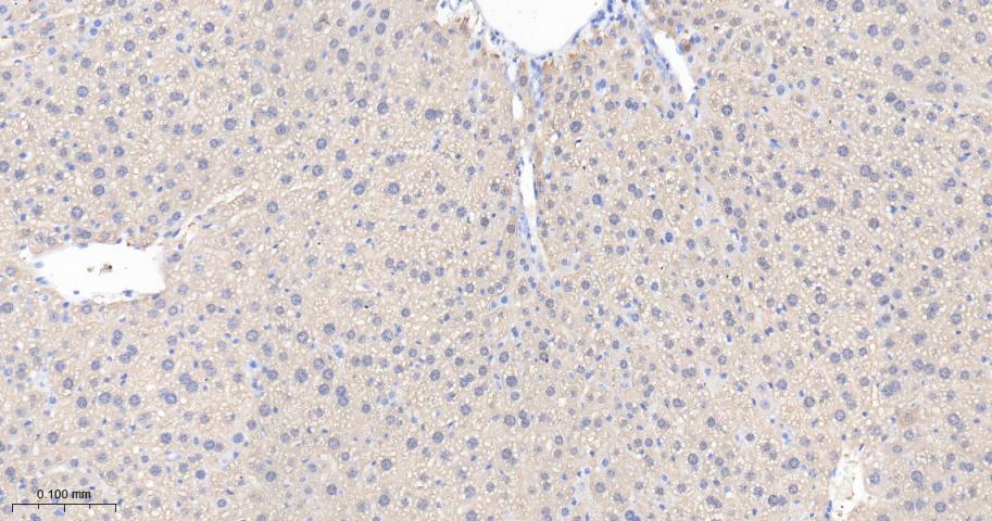 谷草转氨酶重组兔单抗-bsm-63078R