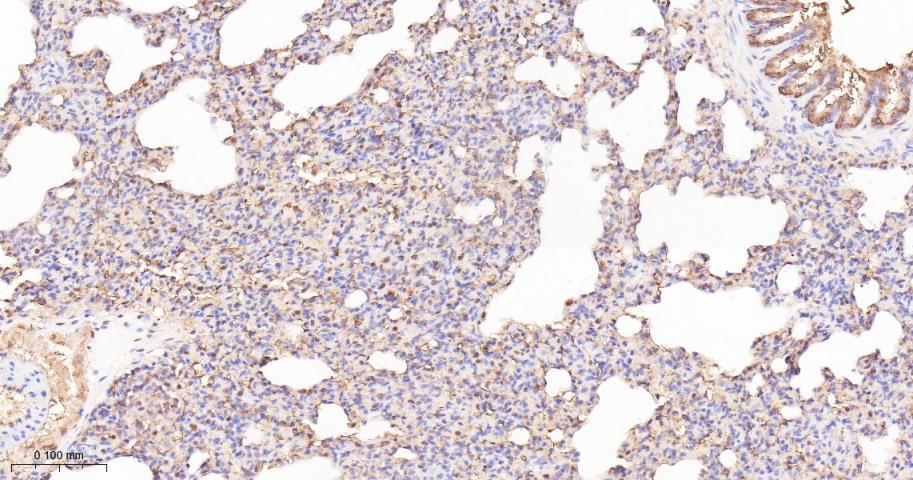 泛素激活酶E1重组兔单抗