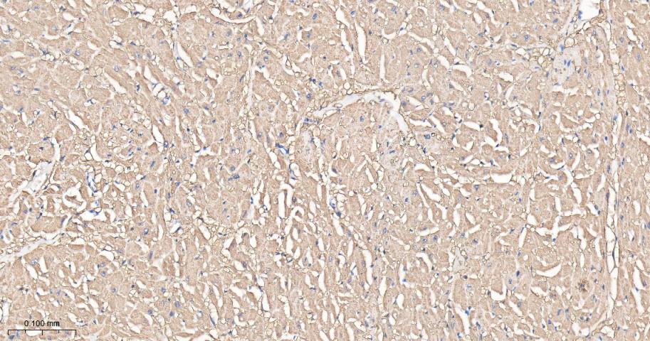 谷草转氨酶重组兔单抗-bsm-63078R
