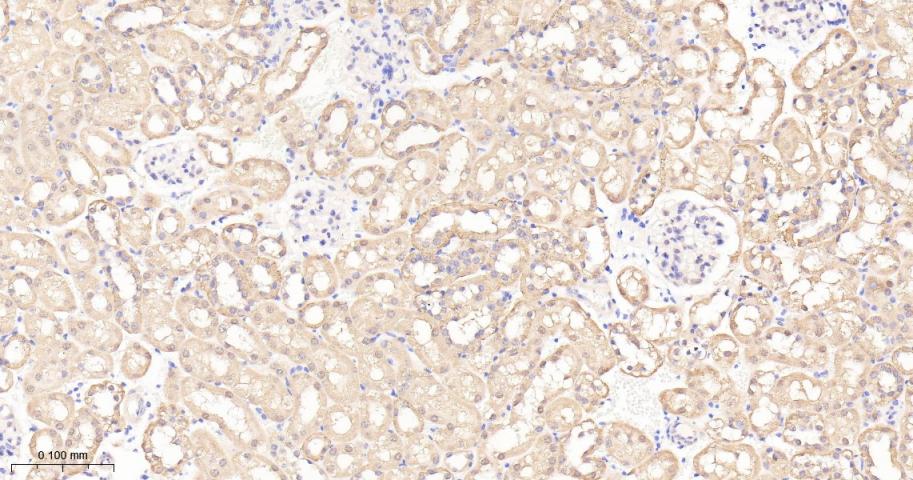 泛素激活酶E1重组兔单抗