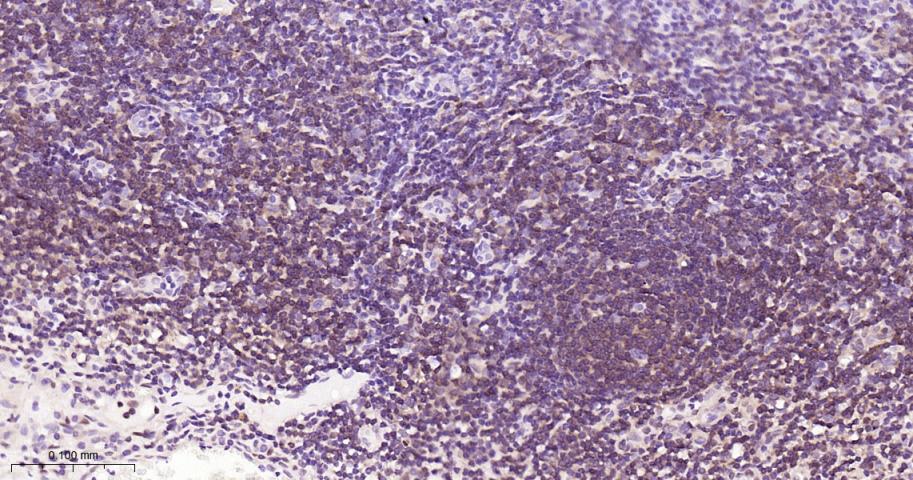细胞核因子/k基因结合核因子单克隆抗体-bsm-33059M