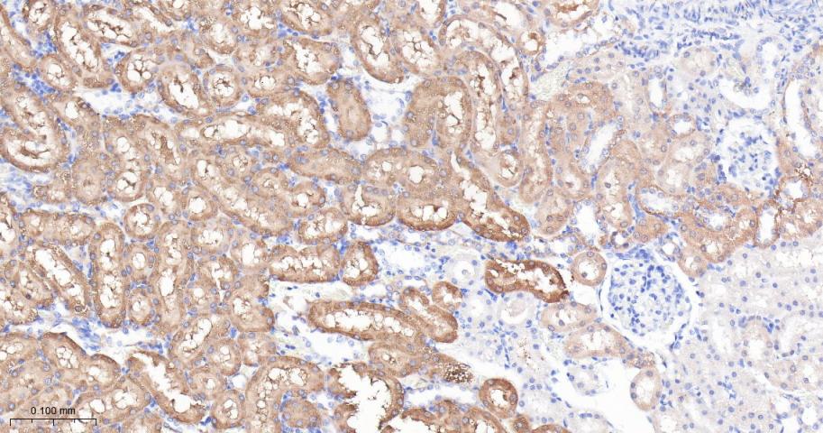 谷草转氨酶重组兔单抗-bsm-63078R