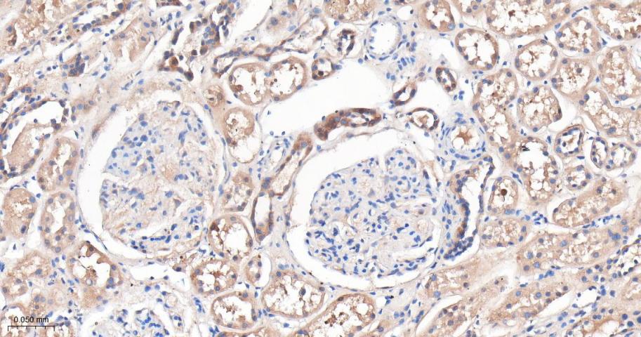 谷草转氨酶重组兔单抗-bsm-63078R