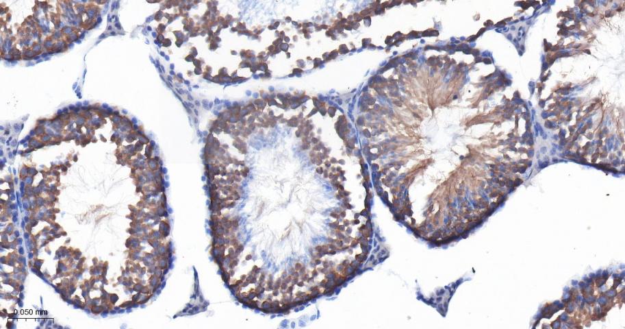 IFT88重组兔单抗