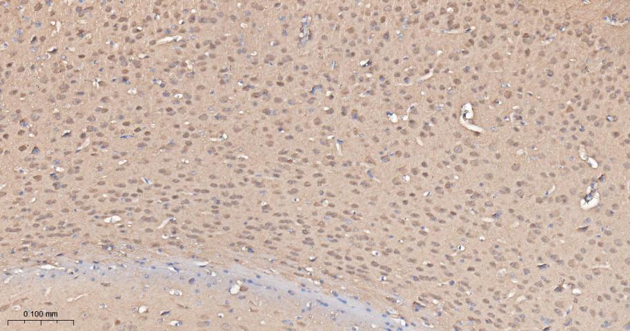 谷草转氨酶重组兔单抗-bsm-63078R