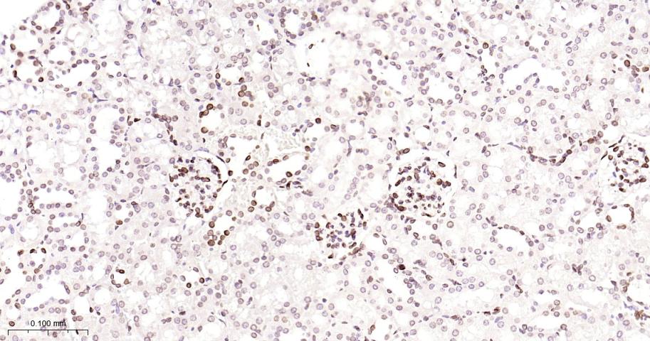 核纤层蛋白B2重组兔单抗