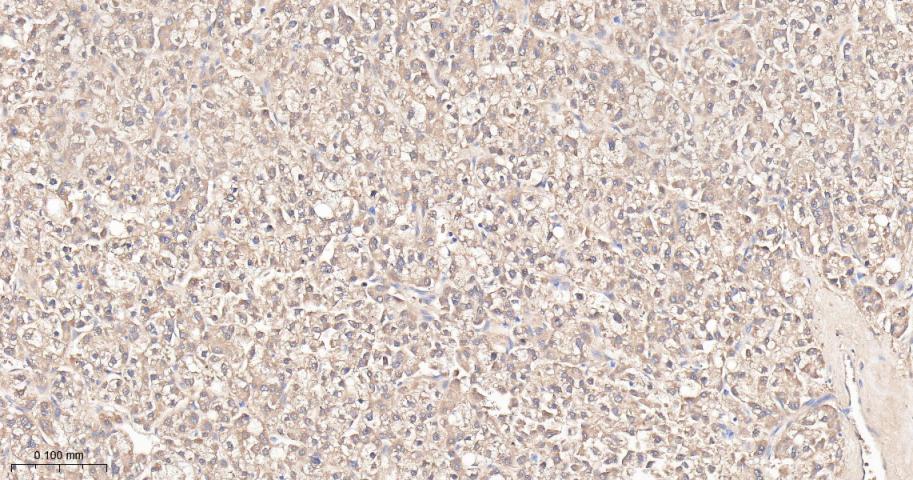 谷草转氨酶重组兔单抗-bsm-63078R