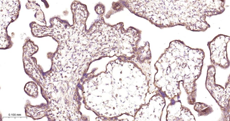 抗增殖蛋白1重组兔单抗-bsm-61208R