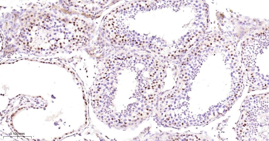 C端结合蛋白1重组兔单抗-bsm-61953R