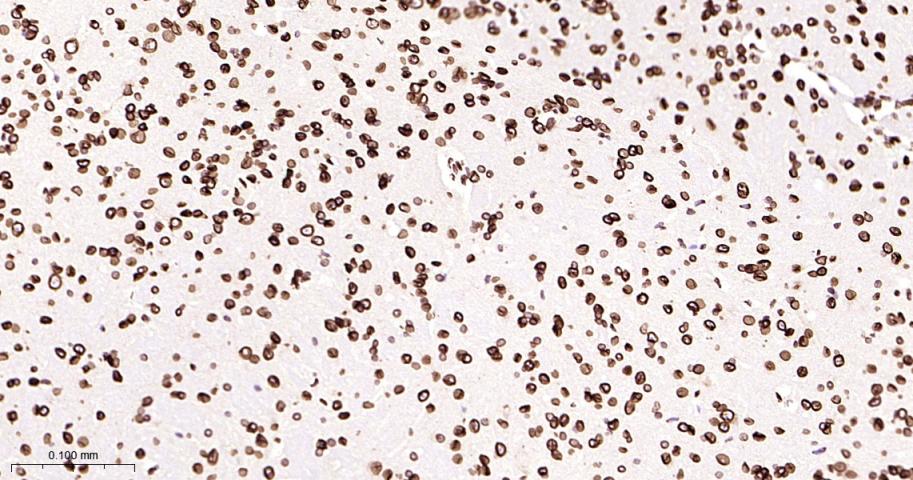 核纤层蛋白B2重组兔单抗