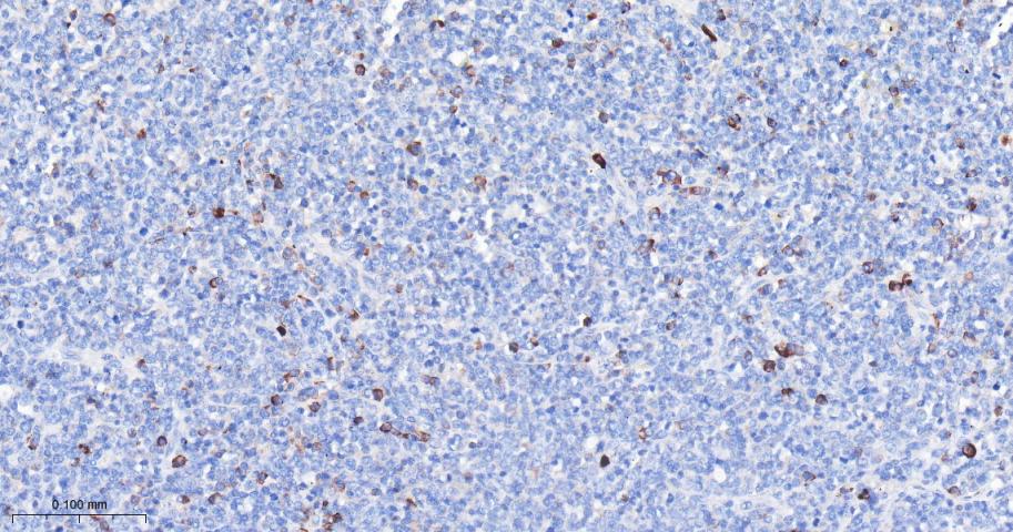 凋亡抑制因子1重组兔单抗-bsm-61518R