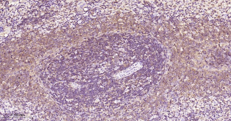 细胞核因子/k基因结合核因子单克隆抗体-bsm-33059M