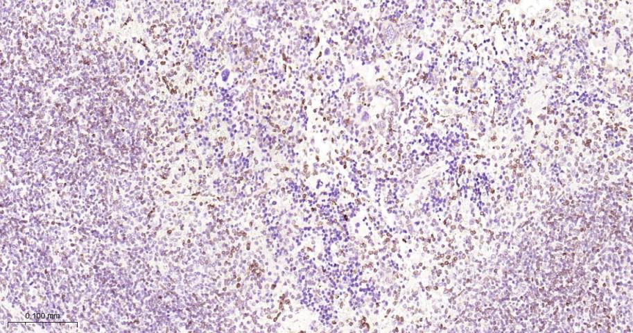 核纤层蛋白B2重组兔单抗