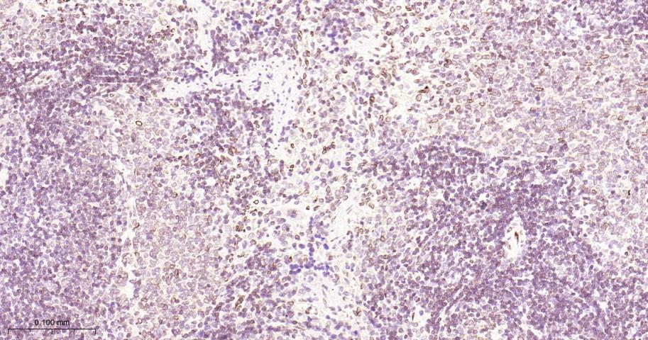 核纤层蛋白B2重组兔单抗