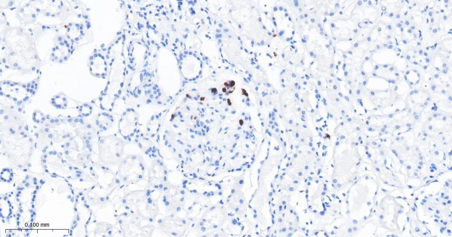 凋亡抑制因子1重组兔单抗-bsm-61518R