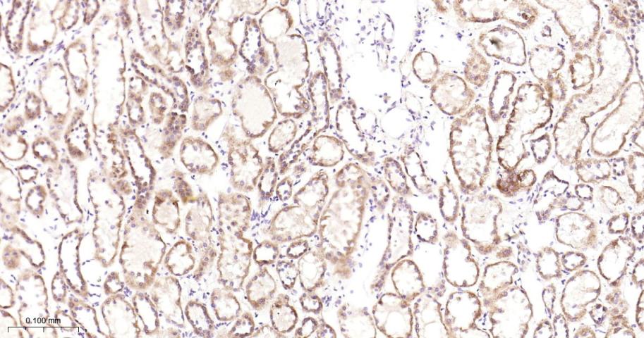 抗增殖蛋白1重组兔单抗-bsm-61208R
