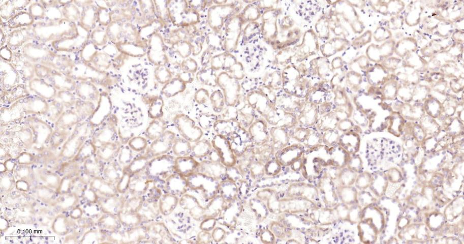 抗增殖蛋白1重组兔单抗-bsm-61208R