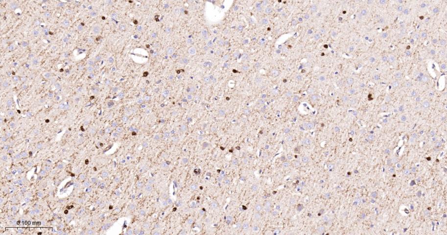 乙酰辅酶A羧化酶重组兔单抗