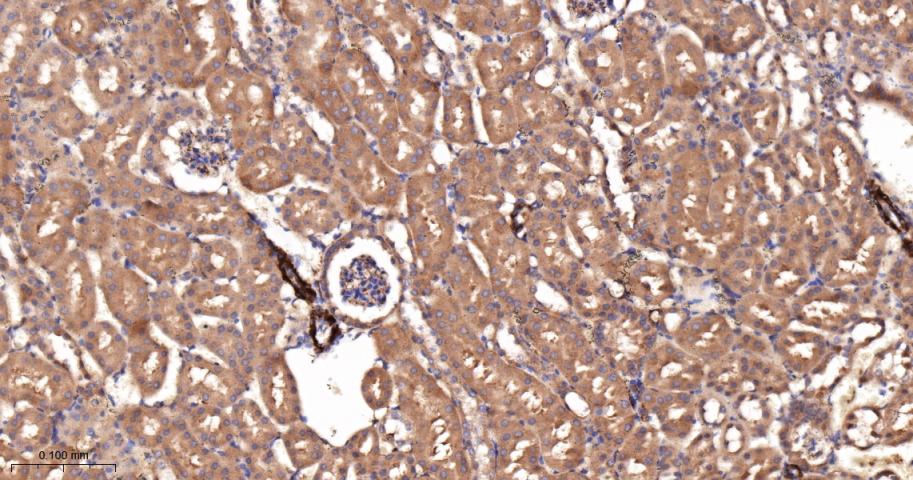 乙酰辅酶A羧化酶重组兔单抗