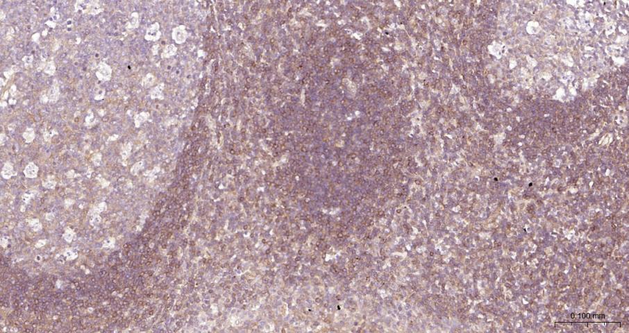 细胞核因子/k基因结合核因子抗体-bs-20160R