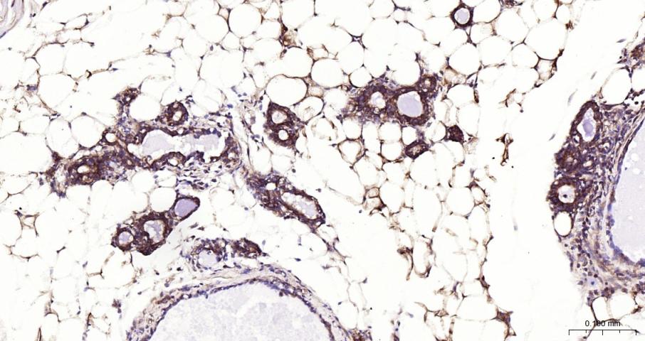 细胞核因子/k基因结合核因子抗体-bs-20160R