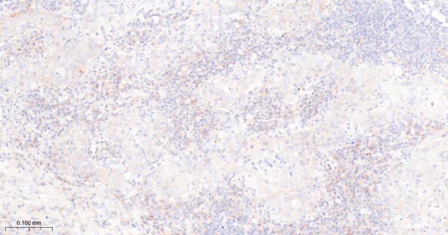 凋亡抑制因子2重组兔单抗