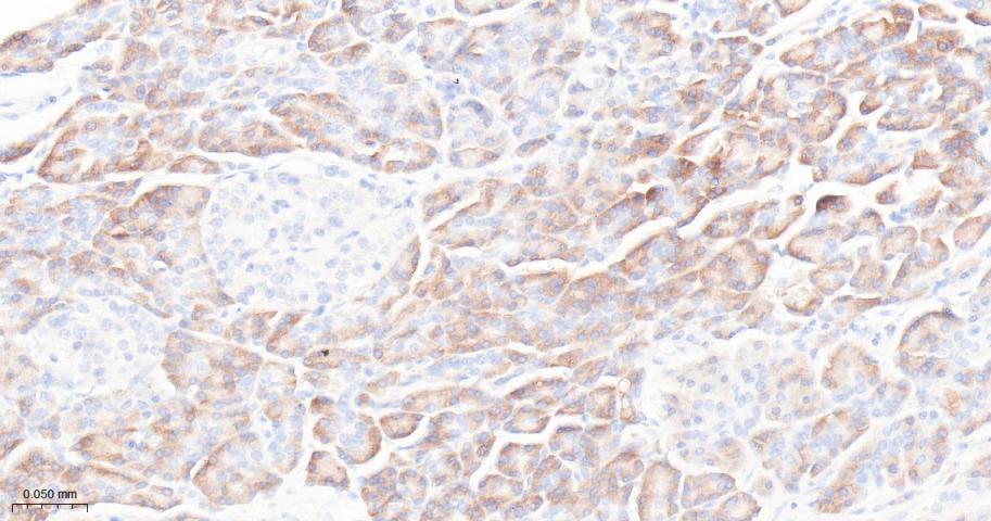 核糖体蛋白S3重组兔单抗