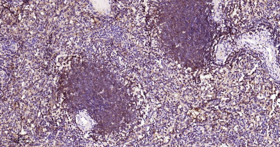 细胞核因子/k基因结合核因子单克隆抗体-bsm-33117M