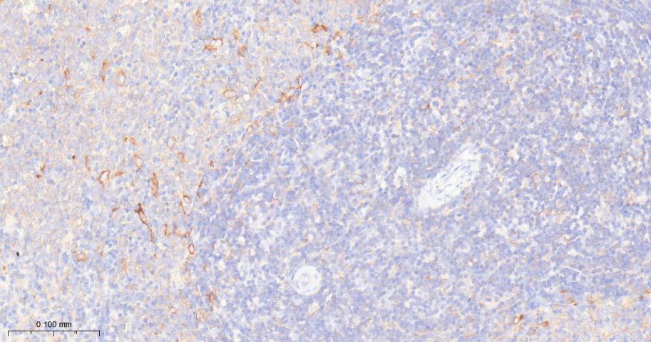 核糖体蛋白S3重组兔单抗