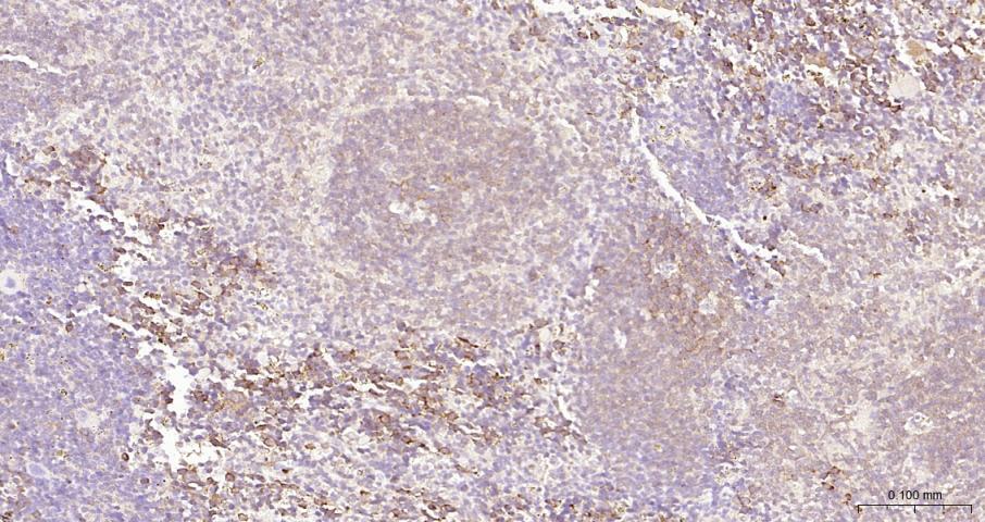 细胞核因子/k基因结合核因子抗体-bs-20160R