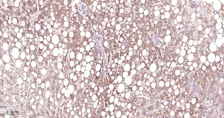 细胞核因子/k基因结合核因子单克隆抗体-bsm-33117M