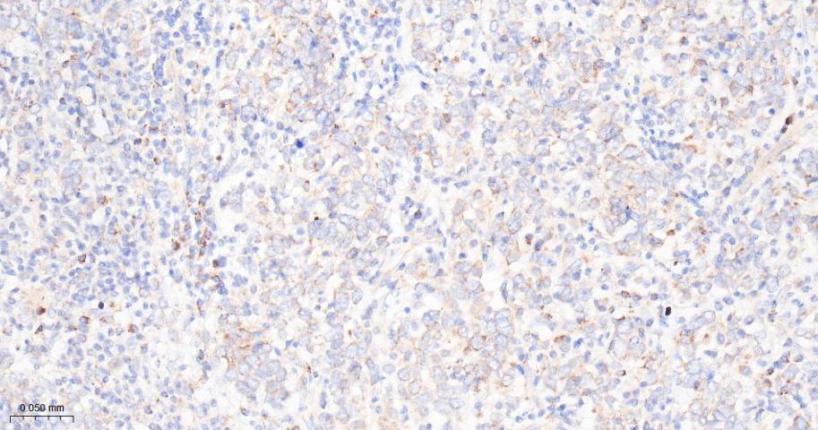 肿瘤坏死因子α诱导蛋白3重组兔单抗