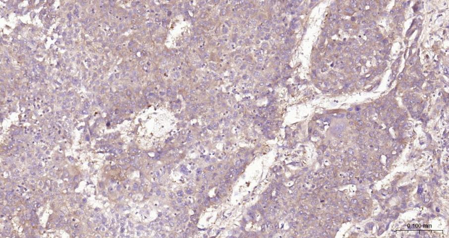 细胞核因子/k基因结合核因子抗体-bs-20160R