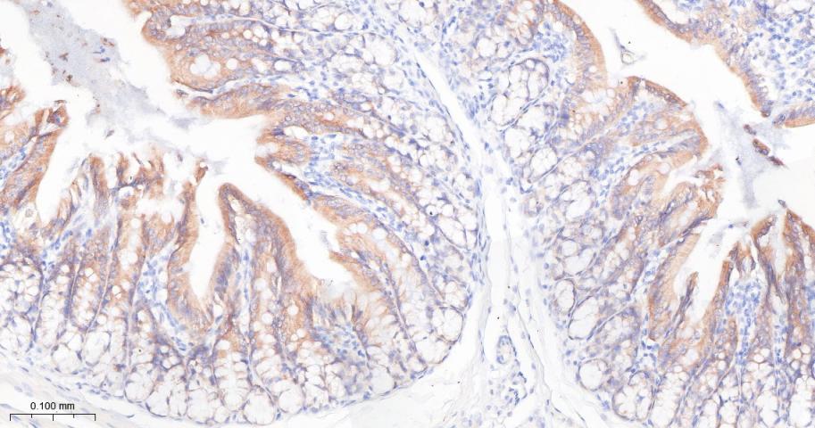 胰岛素样生长因子ⅡmRNA结合蛋白2重组兔单抗