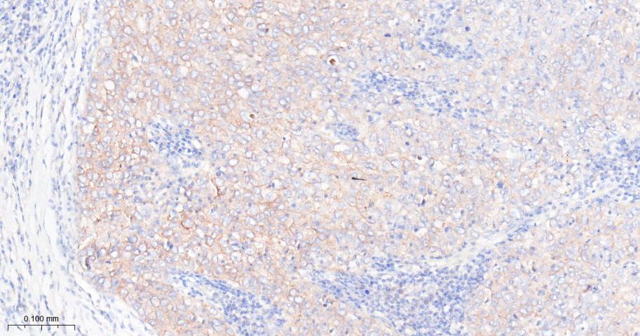 凋亡抑制因子2重组兔单抗