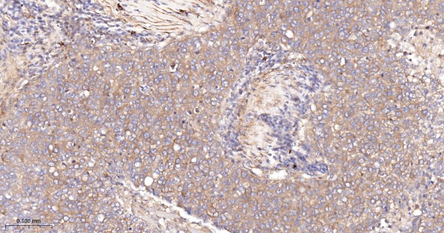 乙酰辅酶A羧化酶重组兔单抗