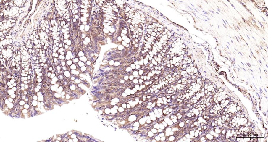 细胞核因子/k基因结合核因子抗体-bs-20160R