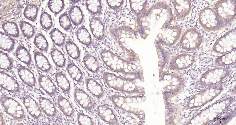 细胞核因子/k基因结合核因子抗体-bs-20160R