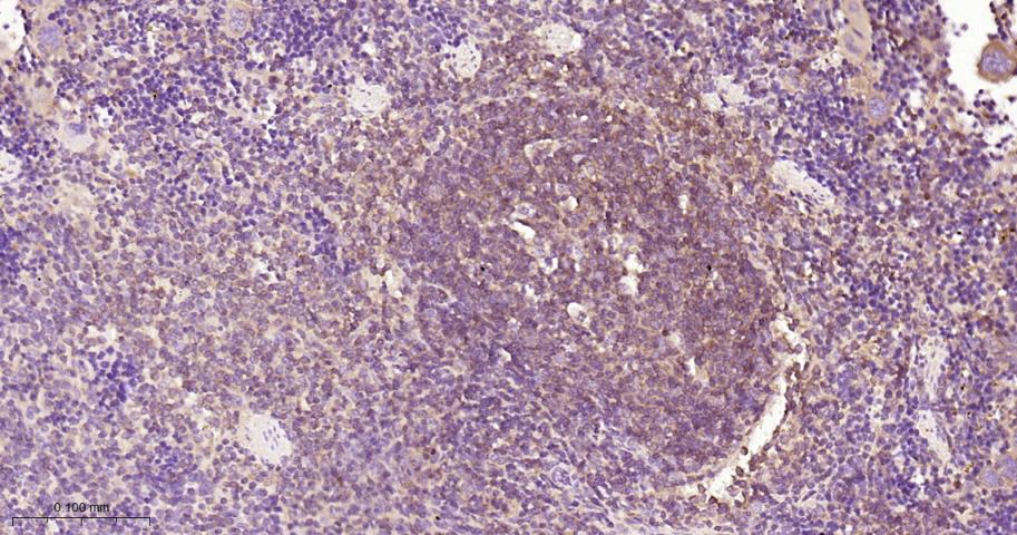 细胞核因子/k基因结合核因子单克隆抗体-bsm-33117M