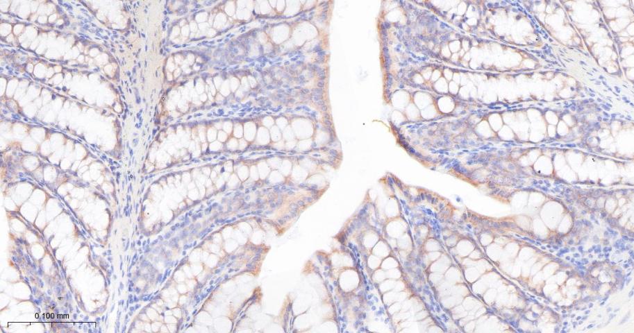 胰岛素样生长因子ⅡmRNA结合蛋白2重组兔单抗