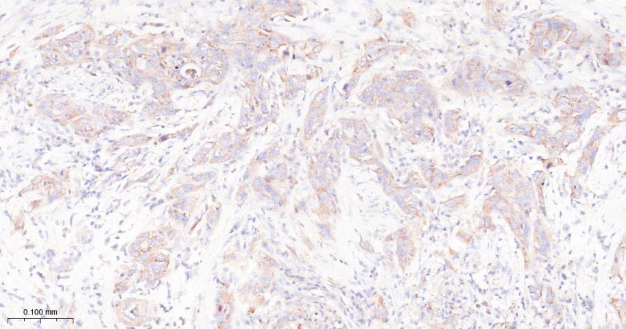 凋亡抑制因子2重组兔单抗