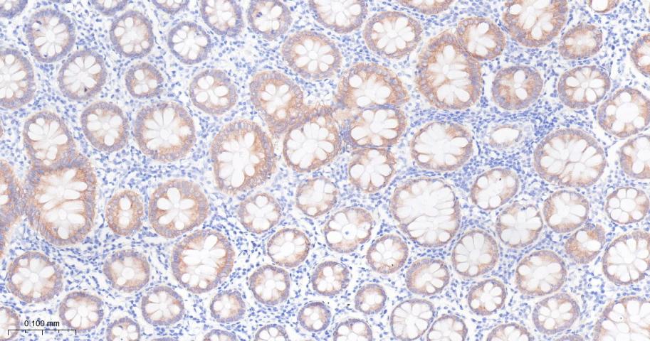 胰岛素样生长因子ⅡmRNA结合蛋白2重组兔单抗