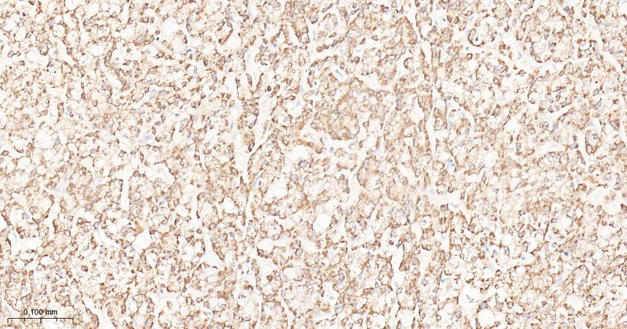 肿瘤坏死因子α诱导蛋白3重组兔单抗