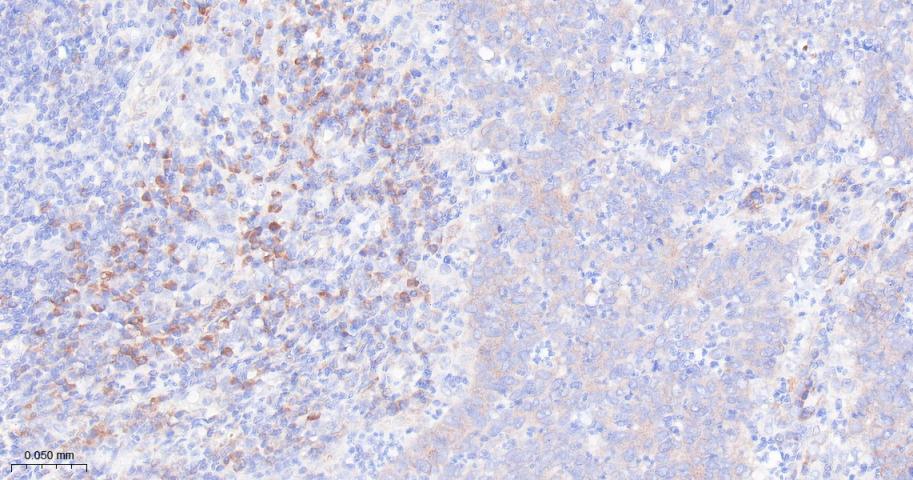 核糖体蛋白S3重组兔单抗