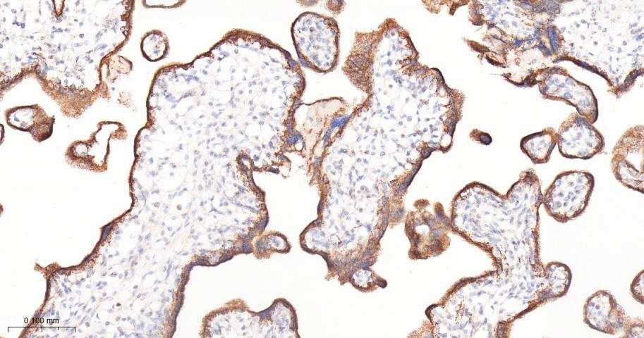 肿瘤坏死因子α诱导蛋白3重组兔单抗