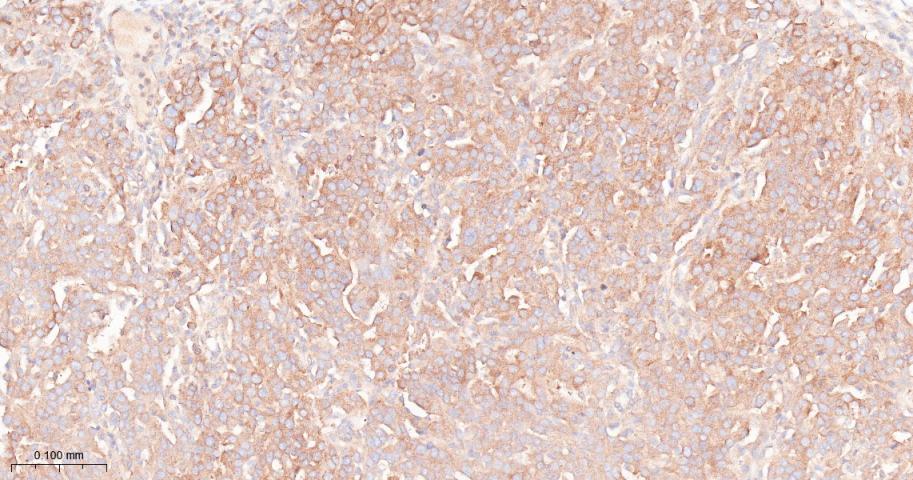 凋亡抑制因子2重组兔单抗
