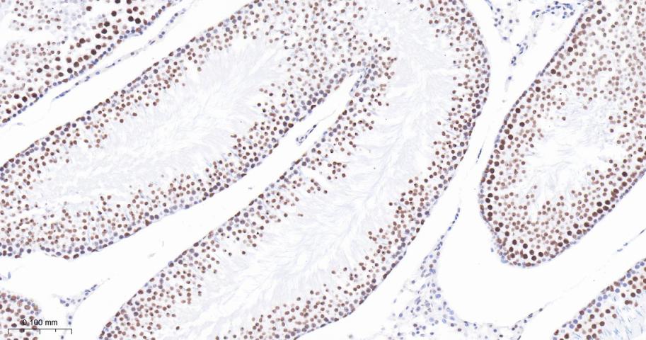 组蛋白去乙酰化酶1（核内参）重组兔单抗