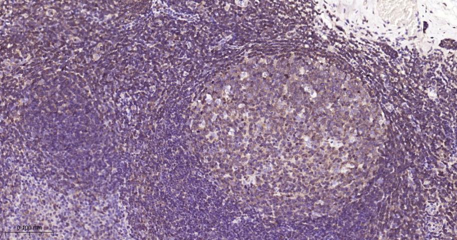 细胞核因子/k基因结合核因子单克隆抗体-bsm-33117M